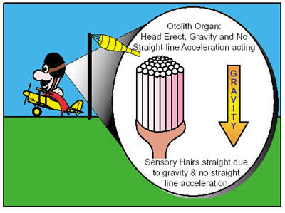  Acting on Figure 3  Straight Line Acceleration Acting On An Otolith Organ  No